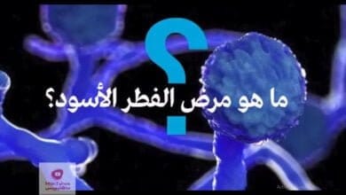 صورة الفطر الأسود | ما هو مرض الفطر الأسود وعلاقته بكورونا وسر انتشاره في الهند وأعراضه