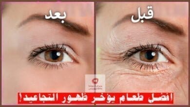 صورة علاج التجاعيد | افضل طعام يؤخر ظهور التجاعيد! ما هو؟