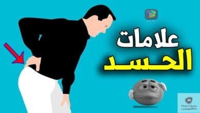 صورة علاج الحسد | هل تعرف علامات وأعراض الحسد العشرة | وما هو أفضل علاج للمحسود؟