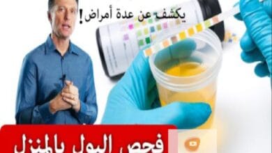 صورة فحص البول المنزلي هذا يخبركم عشرة أمور عن الجسم مثل تضرر الكبد أو حصى الكلى!