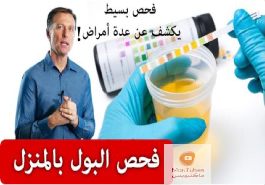 فحص البول المنزلي هذا يخبركم عشرة أمور عن الجسم مثل تضرر الكبد أو حصى الكلى!