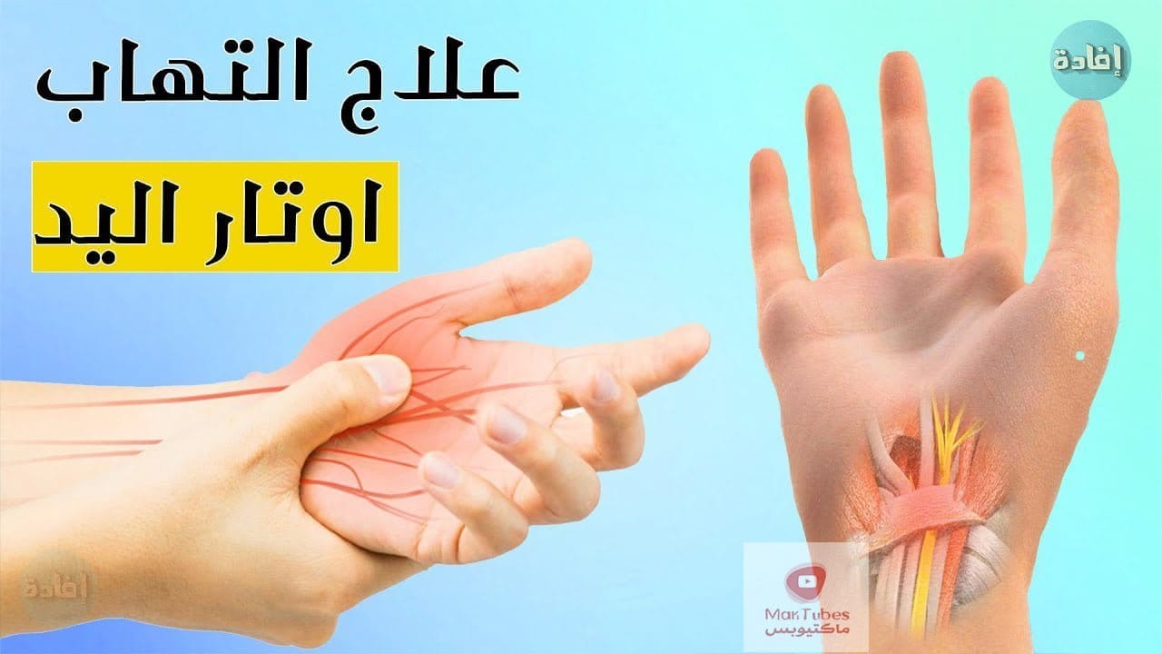 التهاب اوتار اليد | ما هو افضل العلاجات؟ | متى نلجأ للعملية الجراحية؟