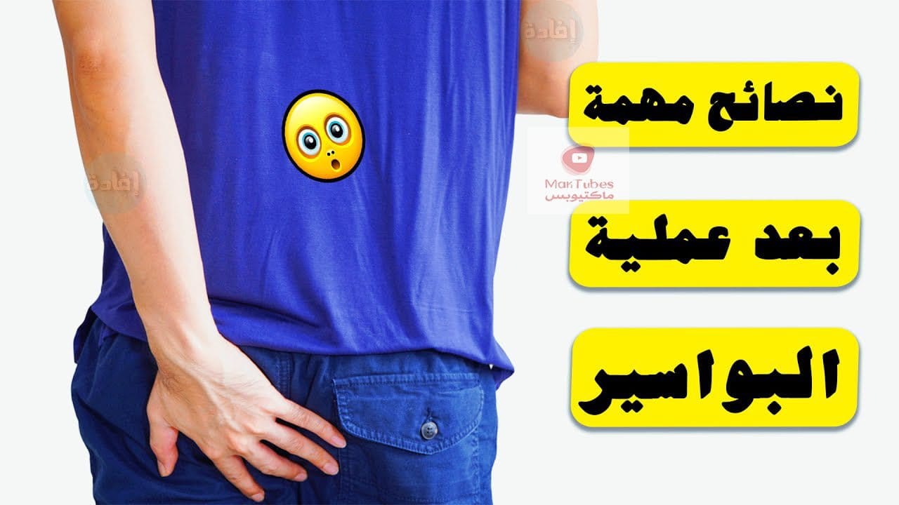 عملية البواسير | نصائح بعد عملية البواسير للشعور بالراحة