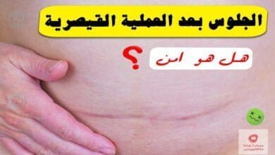 صورة الجلوس بعد العملية القيصرية | ما هي أضرارها | نصائح لتفادي المضاعفات