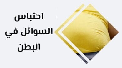 صورة احتباس السوائل في البطن | ما هي اسبابه؟ | وما هو الحل المناسب؟