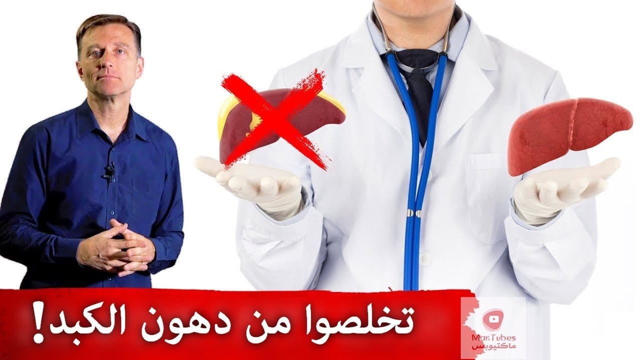 دهون الكبد | ماهي اسبابه وعلاجه | قصة نجاح حقيقية لعلاج دهون الكبد