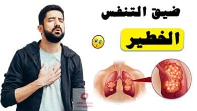 صورة اعراض ضيق التنفس الخطير | متى يجب عليك زيارة الطبيب لعلاج ضيق التنفس؟
