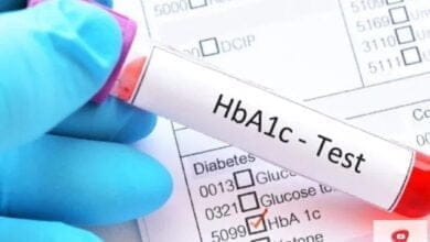 صورة تحليل A1C | اختبار يتنبأ بعدة أمراض ينصح الجميع بإجراءه بشكل دوري A1C 