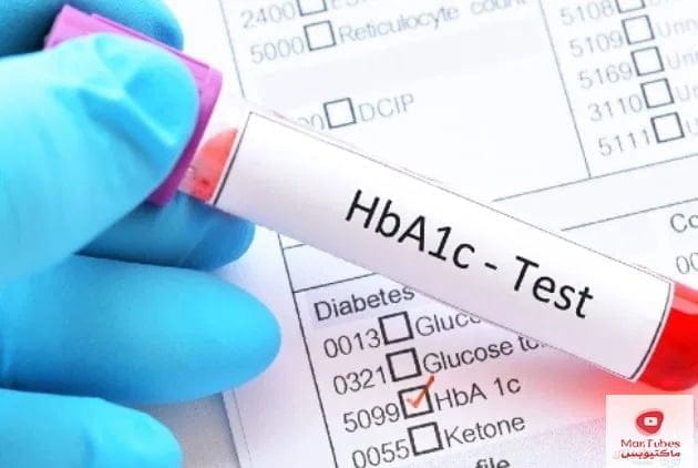 تحليل A1C | اختبار يتنبأ بعدة أمراض ينصح الجميع بإجراءه بشكل دوري A1C