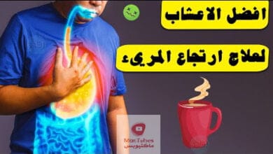 صورة علاج ارتجاع المرئ بالاعشاب | ما هي الخطوات للبدء بالعلاج ؟
