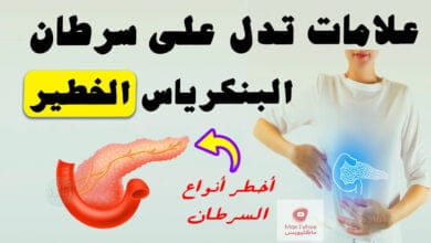 صورة سرطان البنكرياس | أخطر أنواع السرطان ما هي أعراضه؟ وكيف يمكن معالجته؟
