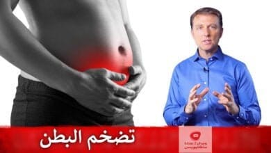 صورة تضخم البطن | ما هو السبب وما هو الحل | وما علاقة الانسولين