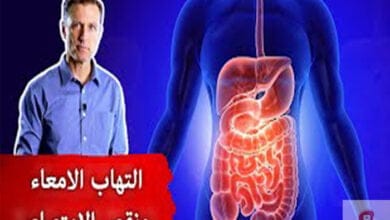 صورة علاج التهاب الامعاء | افضل علاج طبيعي لالتهاب الامعاء تجنب سوء الامتصاص