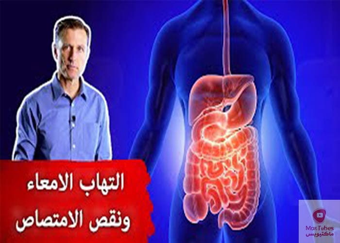 علاج التهاب الامعاء | افضل علاج طبيعي لالتهاب الامعاء تجنب سوء الامتصاص
