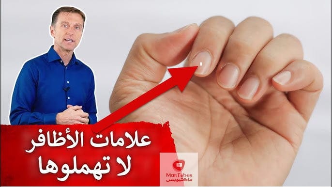 الأظافر | ١٥ علامة على الأظافر تدل على أمراض ونقص فيتامينات ومعادن