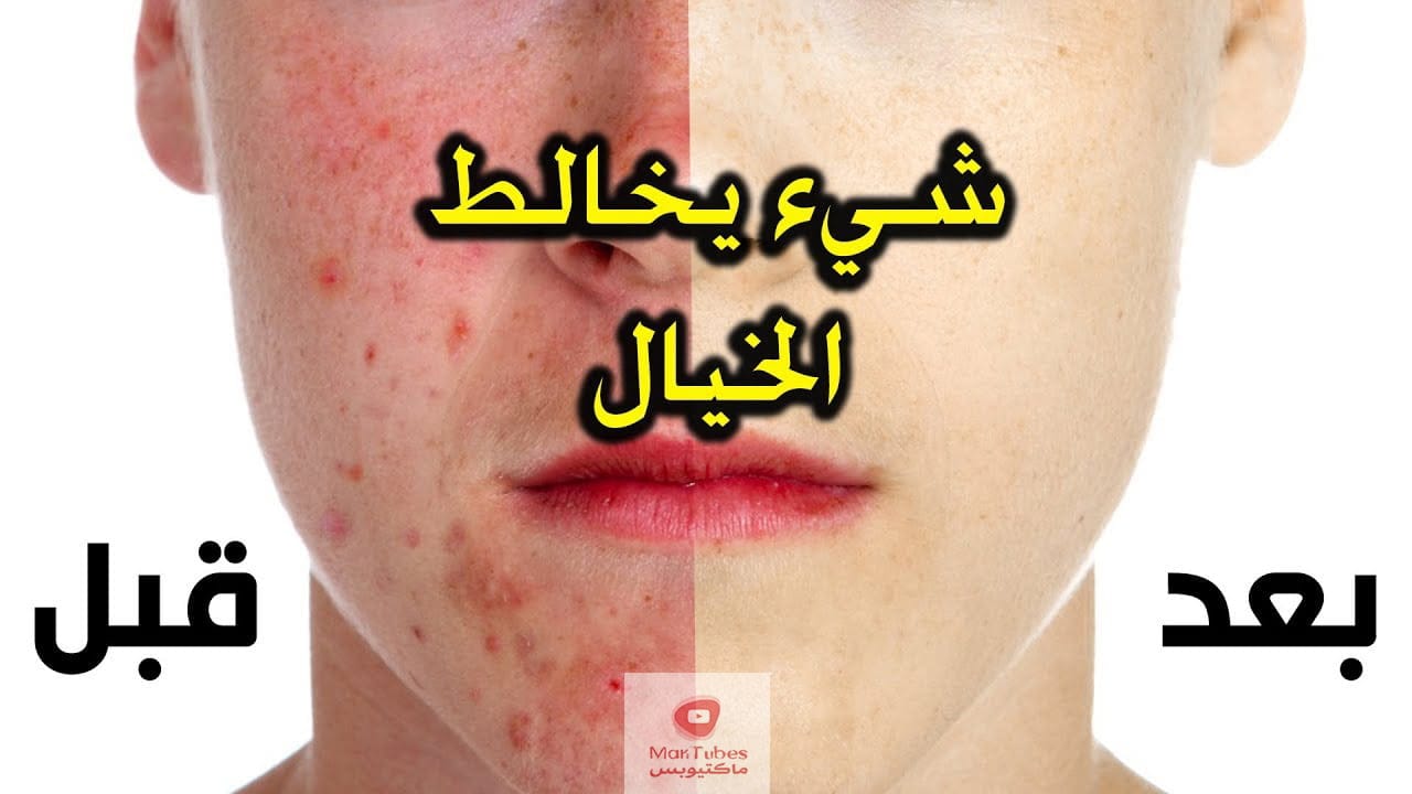 استعمالات الاسبرين | اهم 8 استعمالات منها للبشرة والملابس