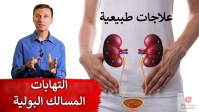 صورة علاج التهابات المثانة | علاجات طبيعية تساعد التهابات المثانة والمسالك البولية