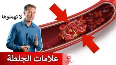 صورة اعراض جلطة القلب والرئة والقدم | علامات قد تدل على وجود تجلطات في الجسم