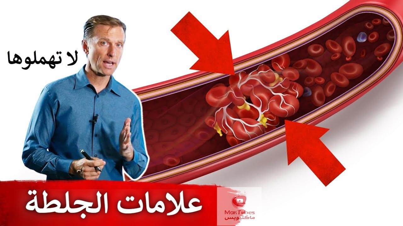 اعراض جلطة القلب والرئة والقدم | علامات قد تدل على وجود تجلطات في الجسم