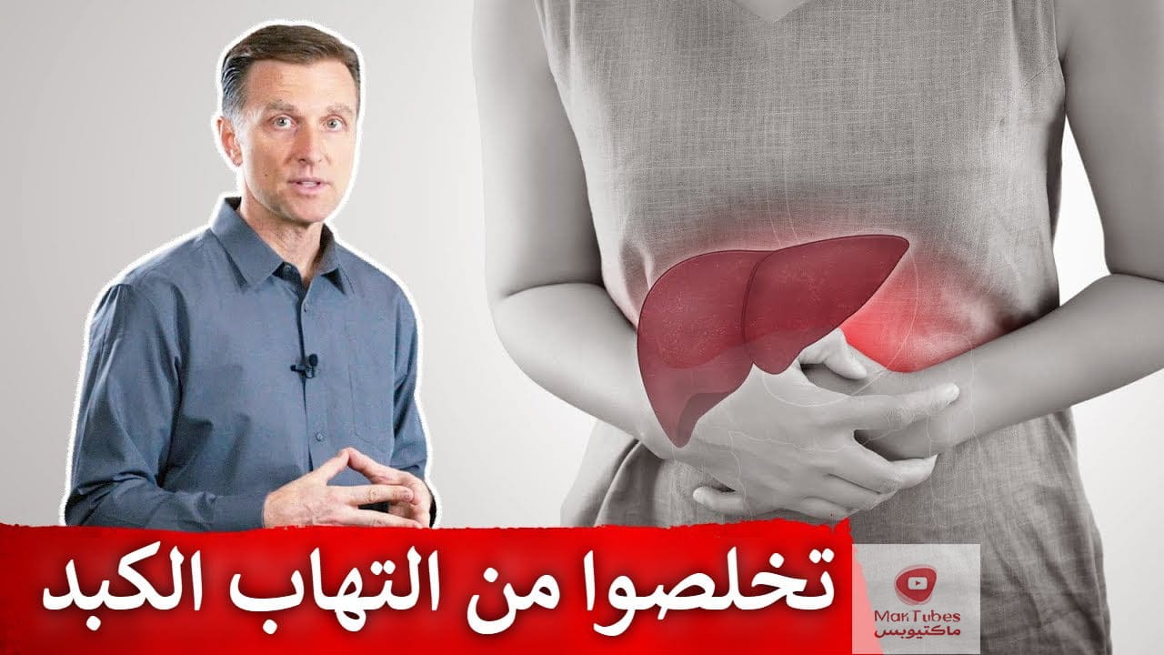 علاج التهاب الكبد | أفضل علاج طبيعي يساعد في التخلص من التهاب الكبد