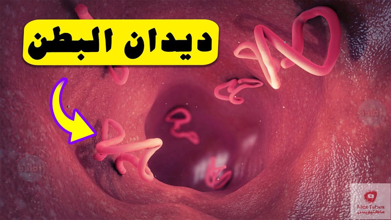 علاج ديدان البطن | الطريقة الصحيحة للتخلص من ديدان البطن