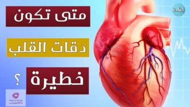 صورة بطئ ضربات القلب | ما هي اسبابها؟ وهل هي حالة خطيرة؟