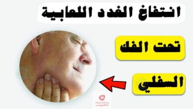 صورة اسباب انتفاخ الغدد اللعابية تحت الفك السفلي | وكيفية علاجها ؟