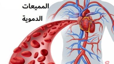 صورة مميعات الدم | الخضار المسموحة والممنوعة عند تناول مميعات الدم