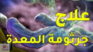 صورة اعراض جرثومة المعدة وعلاجها بأقوى المواد الموجودة في الطبيعة