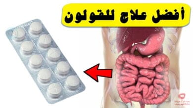 صورة أفضل علاج للقولون من الصيدلية | ما هي الحالات والادوية الممكنة؟