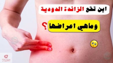 صورة الزائدة الدودية | اين تقع؟ وماهي اعراضها ؟ وهل يمكن منع التهابها؟