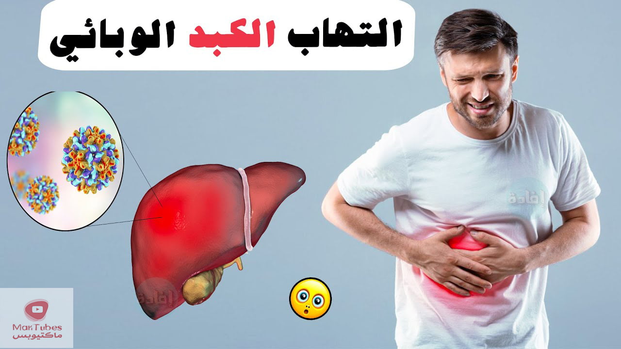 اعراض التهاب الكبد