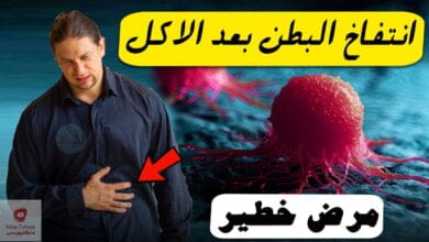 صورة انتفاخ البطن بعد الاكل : قد يكون علامة مبكرة لمرض خطير !