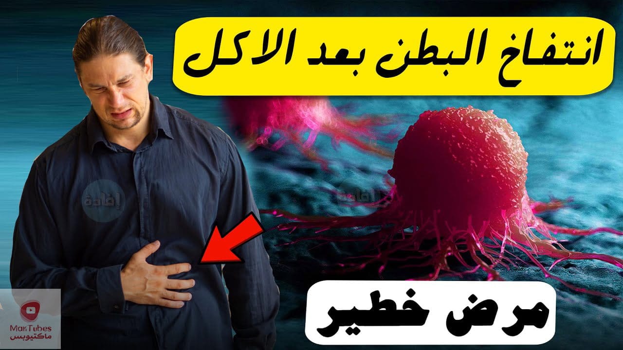 انتفاخ البطن بعد الاكل : قد يكون علامة مبكرة لمرض خطير !