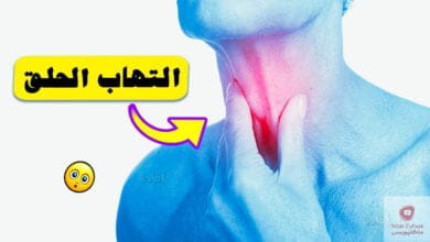 صورة التخلص من التهاب الحلق | كيف ذلك؟ | إليك ثمانية علاجات سريعة