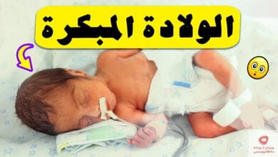 صورة أسباب الولادة المبكرة | وكيف يمكن تجنب الولادة المبكرة ؟