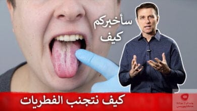 صورة علاج الفطريات | تناولوا هذه البكتيريا للتخلص من الفطريات