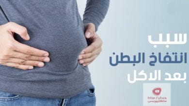 صورة سبب انتفاخ البطن بعد الاكل مباشرة | ما هي العلاجات المناسبة؟