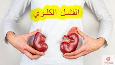 صورة الفشل الكلوي | علامات اذا رأيتها على جسدك فإنها تشير بقرب اصابتك بالفشل الكلوي