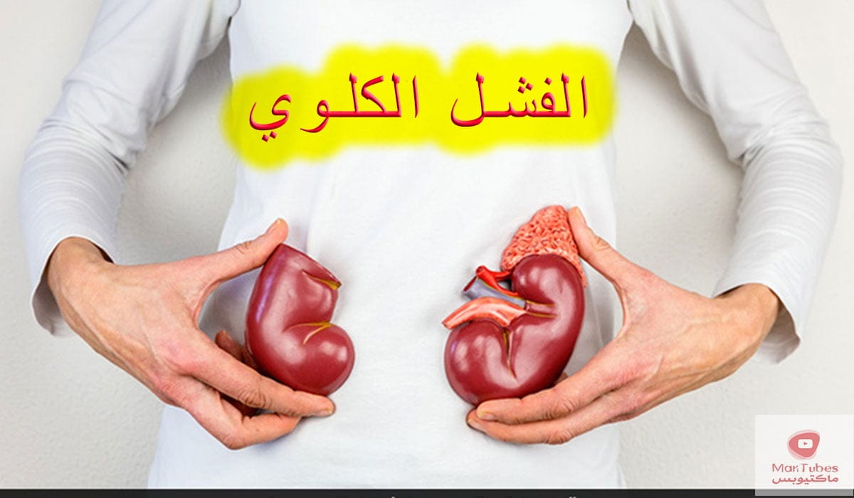 الفشل الكلوي | علامات اذا رأيتها على جسدك فإنها تشير بقرب اصابتك بالفشل الكلوي