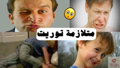 صورة متلازمة توريت ؟ | ما هي؟ وما اعراضها؟ وما هي العوامل التي تزيد من خطر الاصابة بها؟