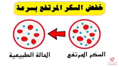 صورة طريقة خفض السكر المرتفع بسرعة | اليك اهم 6 طرق فعالة
