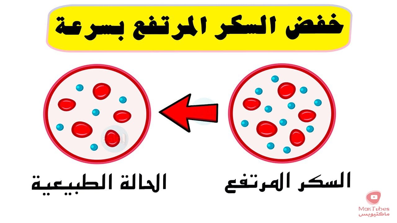 طريقة خفض السكر المرتفع بسرعة | اليك اهم 6 طرق فعالة