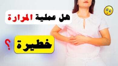 صورة عملية المرارة | متى تحصل ؟ وما هي اعراضها ؟ وما هي مخاطرها؟