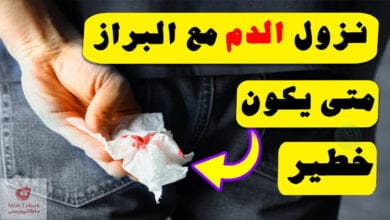 صورة نزول الدم مع البراز | متى يكون هذا الامر خطير؟ و إلى ماذا يشير؟