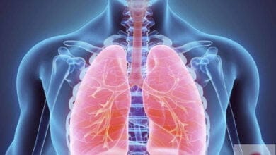 صورة أدوية الانفلونزا “Influenza Drugs”: ما هي اعراضها؟ و ما طرق نقل العدوى؟