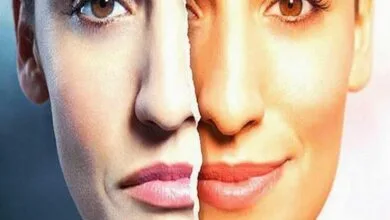 صورة ثنائي القطب – ما هو هذا المرض ؟