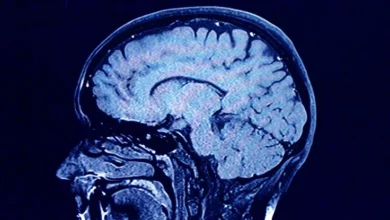 صورة فقدان الشهية يمكن أن يؤدي إلى تغييرات جذرية في بنية الدماغ