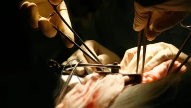 صورة زرع الكلى للأطفال – تقنية بارعة بإجراء عمليات زرع الكلى للأطفال دون تثبيط المناعة